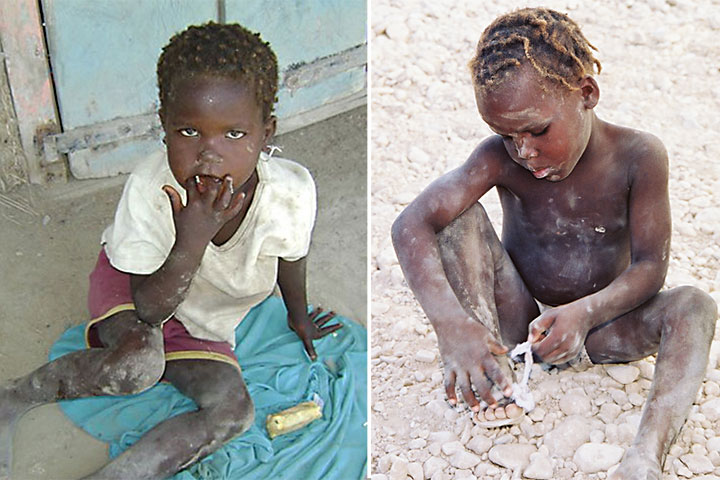 2-starving-children