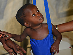 Another young patient at our Malnutrition Center in Haiti