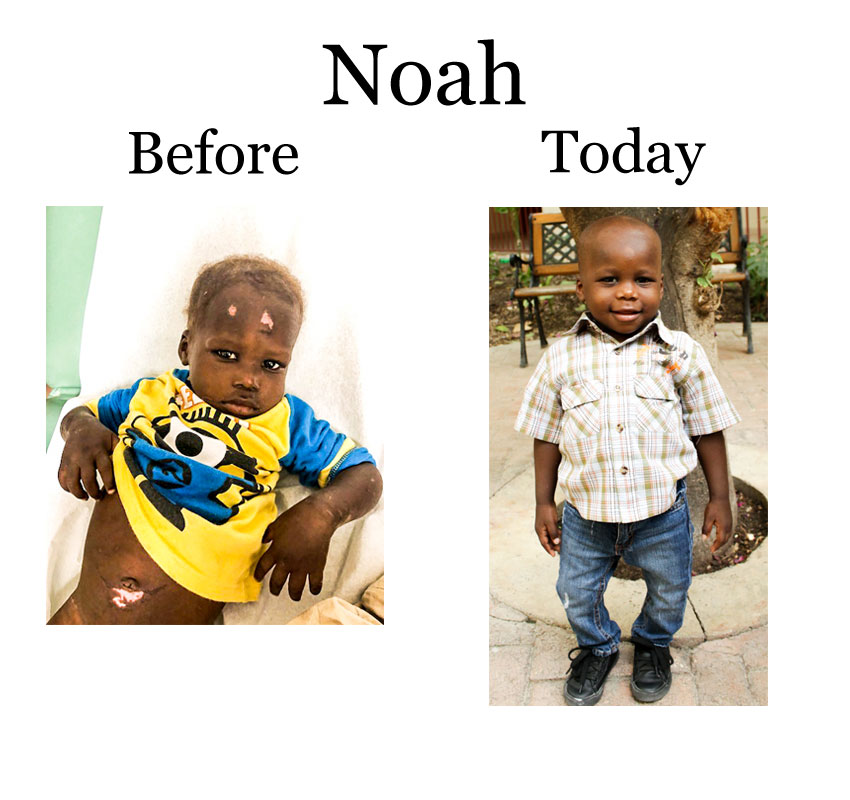 Update Noah:  8-18-18   7:00 PM