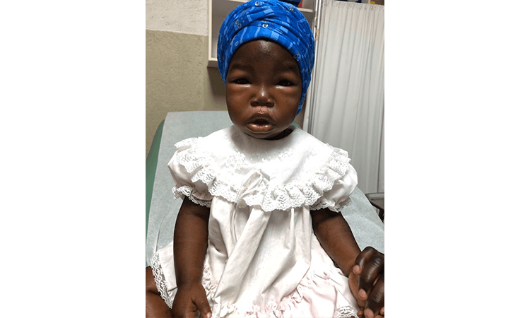 More Cases of Malnutrition: 4-23-19 9:00 AM