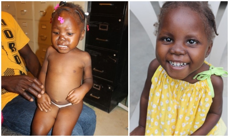 Helping Sanika and Other Children
