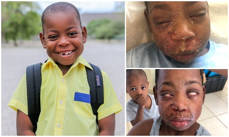 Update on Jameson