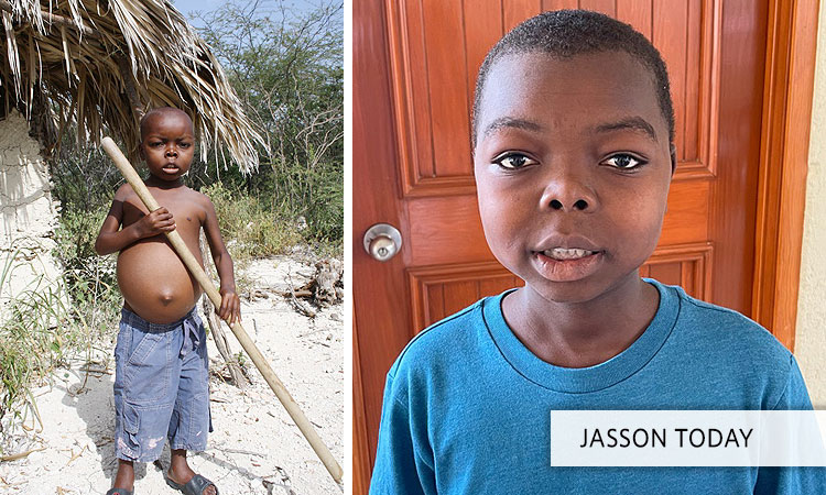 Update on Jasson (Jackson)