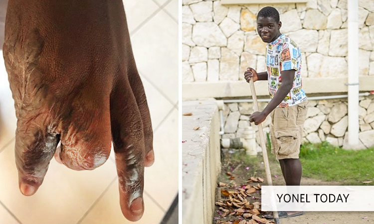 Update on Yonel (Lionel)